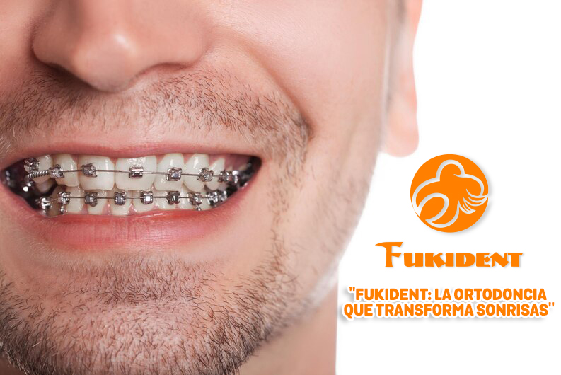 La ortodoncia es un campo de la odontología que se dedica al estudio y tratamiento de las maloclusiones y problemas de alineación dental.